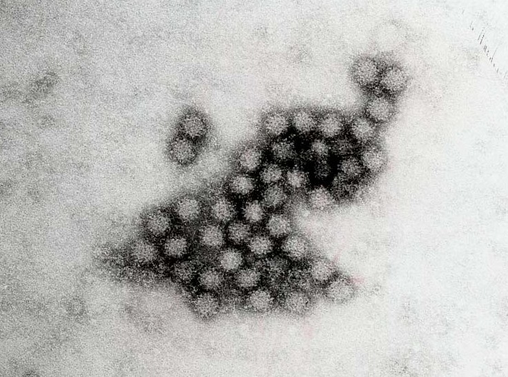 norovirus.jpg